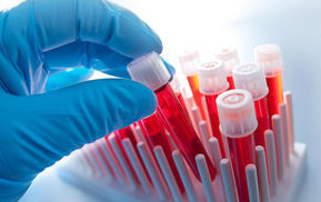 Picture for category HEMATOLOGY   